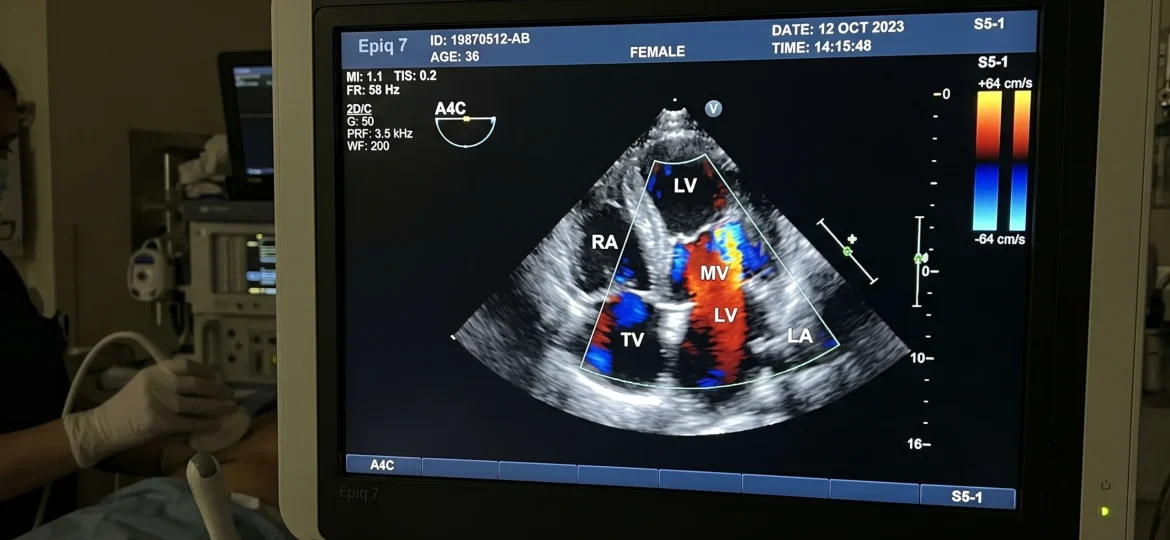 Ecocardiograma en Guatemala